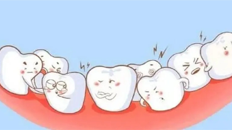 矫正牙齿需要多少钱 牙齿矫正一般大概多少钱